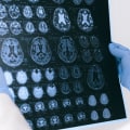 Unlocking the Power of Consciousness and Subconsciousness